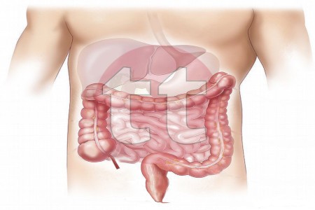Curso TCAE Atención trastorno digestivo
