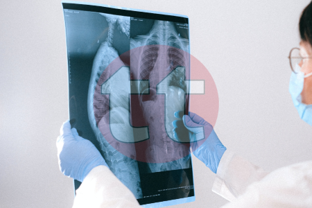cursos online baremables puntuables de técnicos en imagen para el diagnóstico rayos x